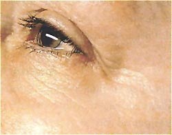 Anti-Aging-n